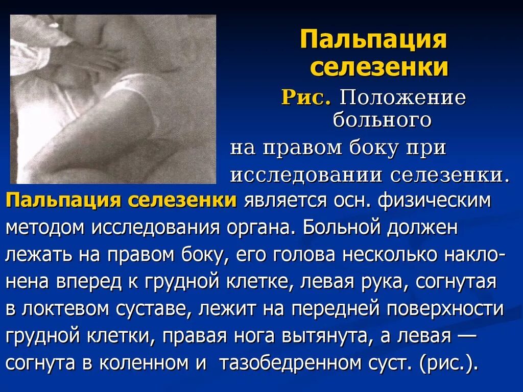 Состояние селезенки. Положение пациента при разрыве селезенки. Положение пациента при пальпации селезенки. Разрыв селезенки положение больного.