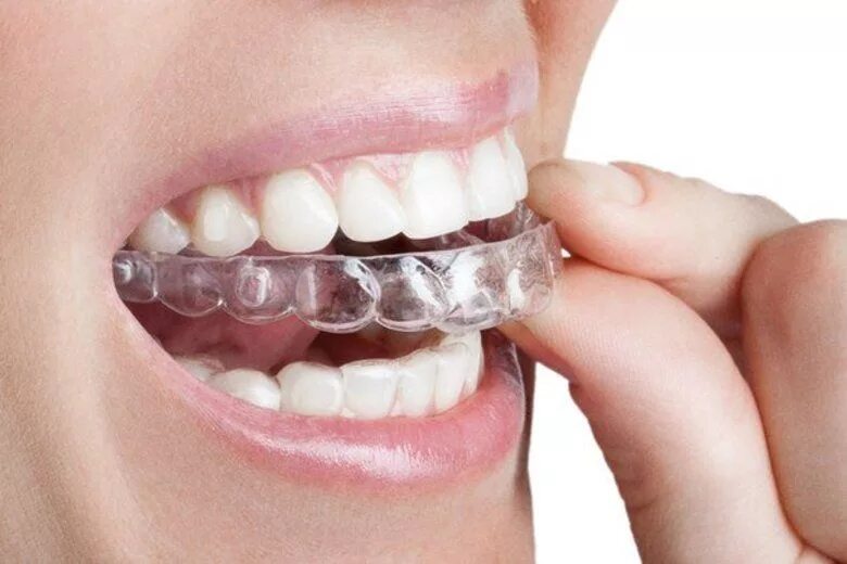 Капа для бокса flamma ice hits. Капа adibp093 single mouth guard thermo flexible р. Золотая капа цветная. Футляр для элайнеров. Невидимые брекеты элайнеры.