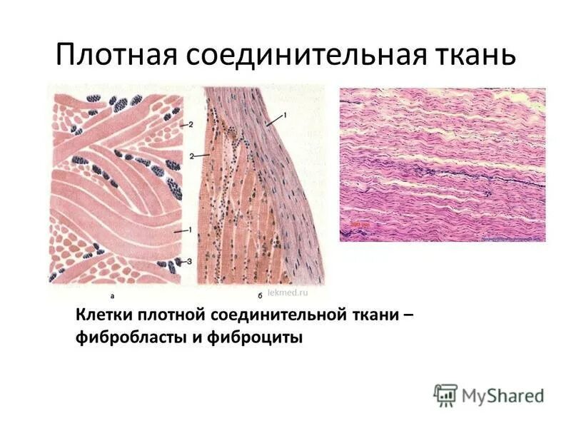 Плотная волокнистая неоформленная соединительная ткань. Строение фиброцита гистология. Функции фибробластов соединительной ткани. Строение фибробластов гистология. Фибробласты рыхлой соединительной ткани.