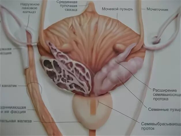 Везикулит симптомы и лечение у мужчин. Семенной бугорок предстательной железы. Семенные пузырьки анатомия. Семенной бугорок анатомия.