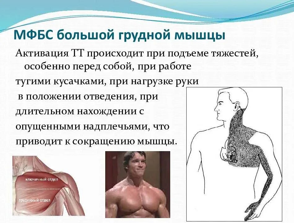 Синдромы мышц. Миофасциальный болевой синдром трапециевидной мышцы. мфбс малой грудной мышцы симптомы. синдром большой грудной мышцы. миофасциальный синдром большой грудной мышцы.