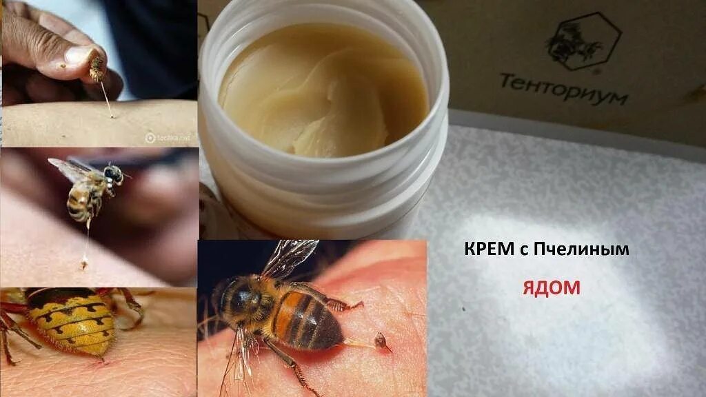 Укус пчелы лечение
