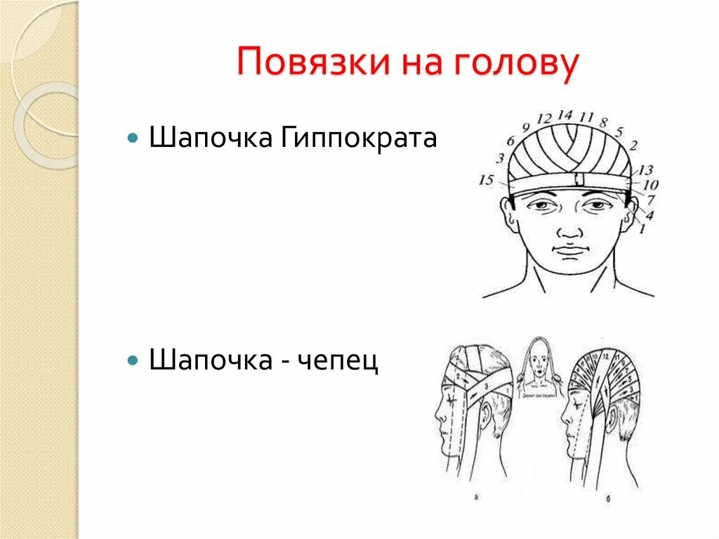 Шапочка Гиппократа повязка на голову. Повязка чепец и шапочка Гиппократа. Повязка шапка Гиппократа техника. Наложение повязки шапка Гиппократа. Повязки на голову шею