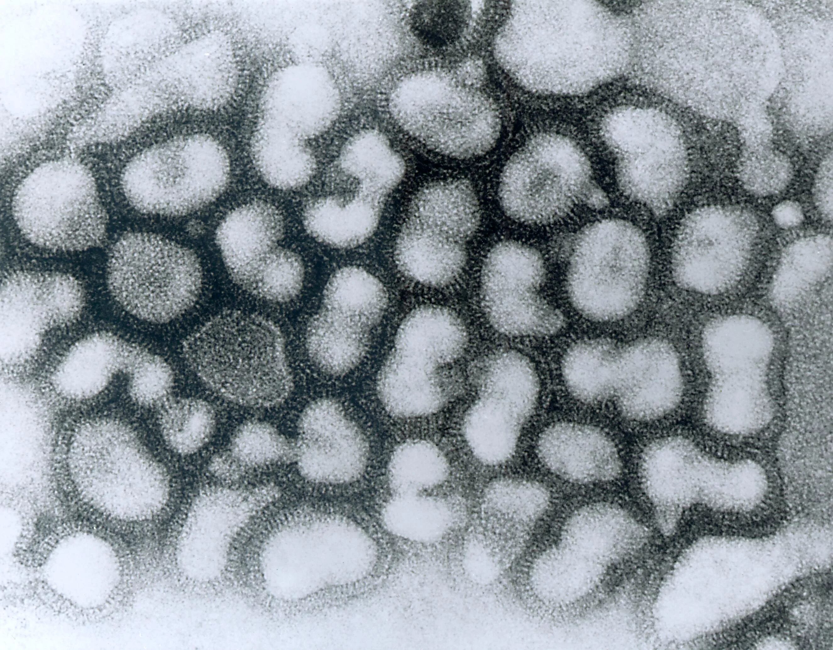Вирус гриппа под. Вирус гриппа микрофотография. Вирус h5n1. Электронная микрофотография вируса гриппа а. Вирус птичьего гриппа под микроскопом.
