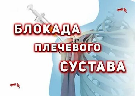 Блокада сустава препараты