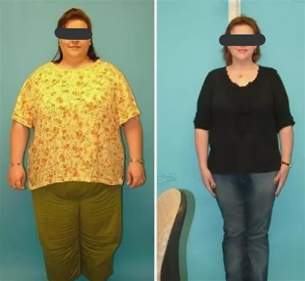 после уменьшения желудка