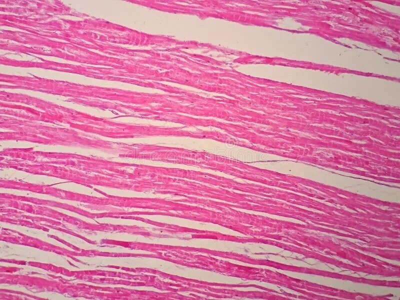 Transverse Section Of Skeletal Muscle