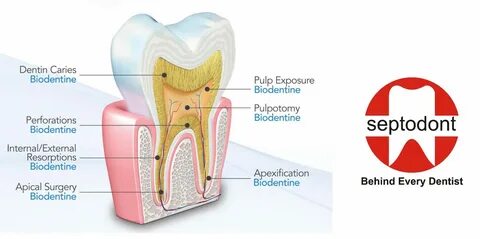 Biodentine Box of 5 - Universal Dental (Pvt) Ltd. 