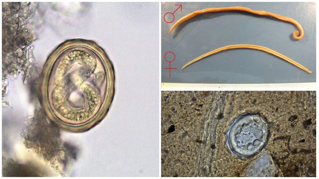 В каких органах личинки аскариды. Яйца гельминтов аскариды. Человеческая аскарида (Ascaris lumbricoides).