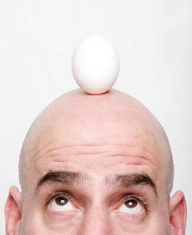 Прическа яйцо. Прическа яйцо на голове. Голова в форме яйца. Реклама для стрижки яичек