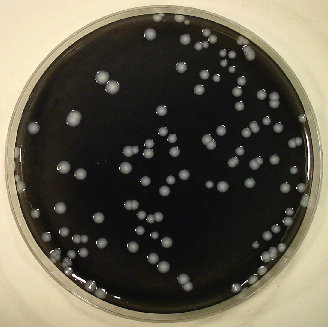 Legionella pneumophila микробиология. Легионеллы культуральные. Возбудитель легионеллы. Бордетеллы легионеллы.