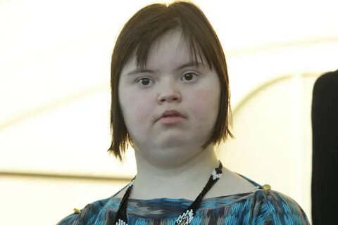 Люди с болезнью дауна