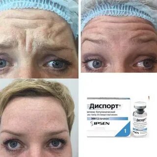 Уколы диспорт отзывы