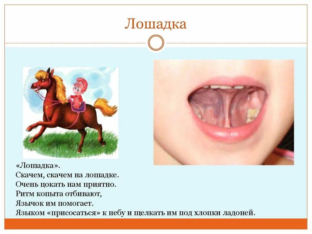 Лошадка артикуляционная. Упражнение лошадка артикуляционная гимнастика. Артикуляционная гимнастика лошадка цокает. Логопедия для детей артикуляционная гимнастика лошадка. Артикуляция упражнения лошадка.