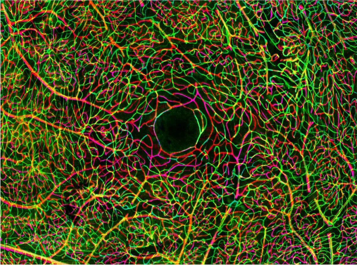 Конфокальная микроскопия мозга. Клетки сетчатки микрофото. Конфокальная микроскопия глаза. Центр сетчатки