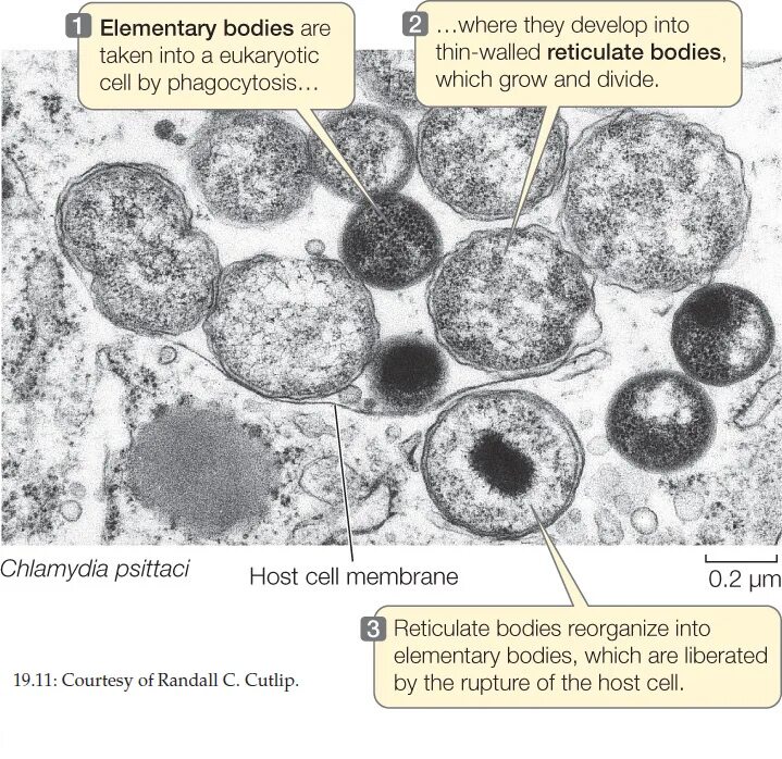 Chlamydia psittaci устойчивость. Elementary bodies.