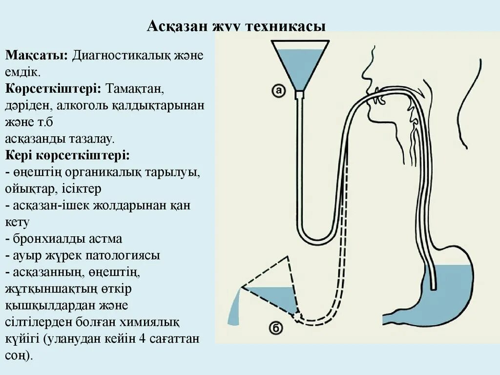 Промывание желудочного зонда алгоритм. Промывание желудка зондом алгоритм. Желудочный зонд для промывания желудка. Проведение зондового промывания желудка.