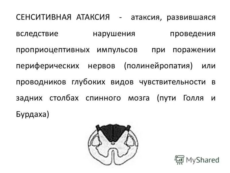 Виды атаксии