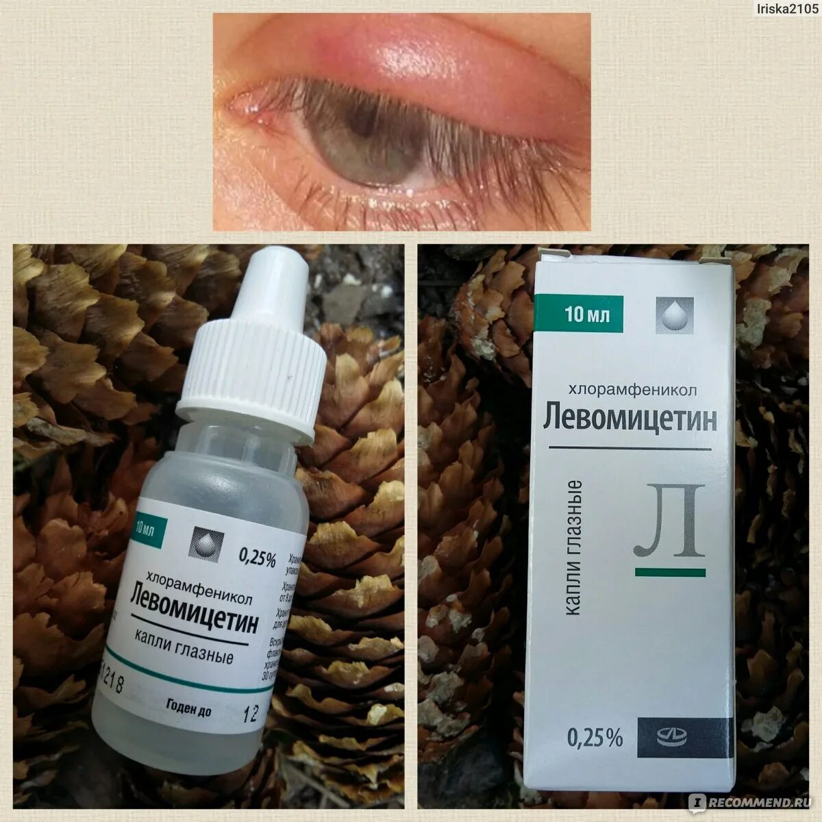 Капли глазные от ячменя для детей на глазу. Глазные капли ортоферон. Офтальмоферон капли глазн фл-кап 10мл. Противомикробные капли для глаз от ячменя. 10мл.