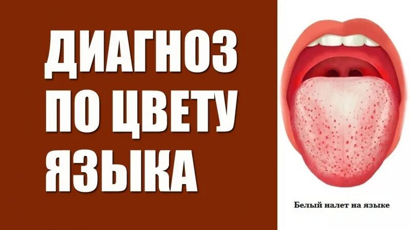 Язык человека определить болезнь. Болезни желудка по цвету языка. Диагностика заболеваний по языку. Диагностика заболеваний по цвету языка.