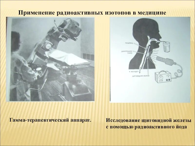 Исследование изотопами. Радиоактивные изотопы в медицине. Использование радиоактивных изотопов в медицине. Радиоактивные изотопы в биологии и медицине. Применение радиоактивных изотопов в биологии и медицине.