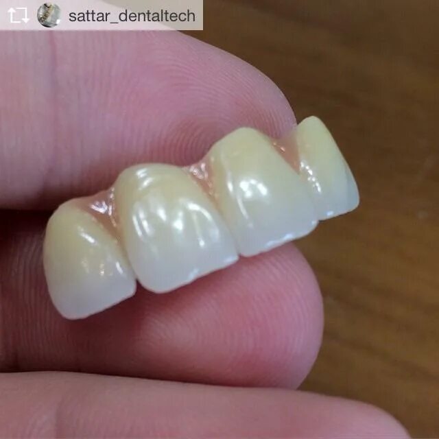 профессия зубной техник. зубной техник махачкала. зубной техник махачкала. зубной техник красный сулин. зубной техник махачкала.