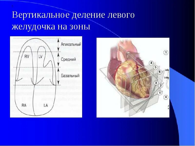Сформулировать основание деления для понятия пример. Теория игр формулы. Наглядность для математики деление. Теория игр задачи с решением. Левое деление.