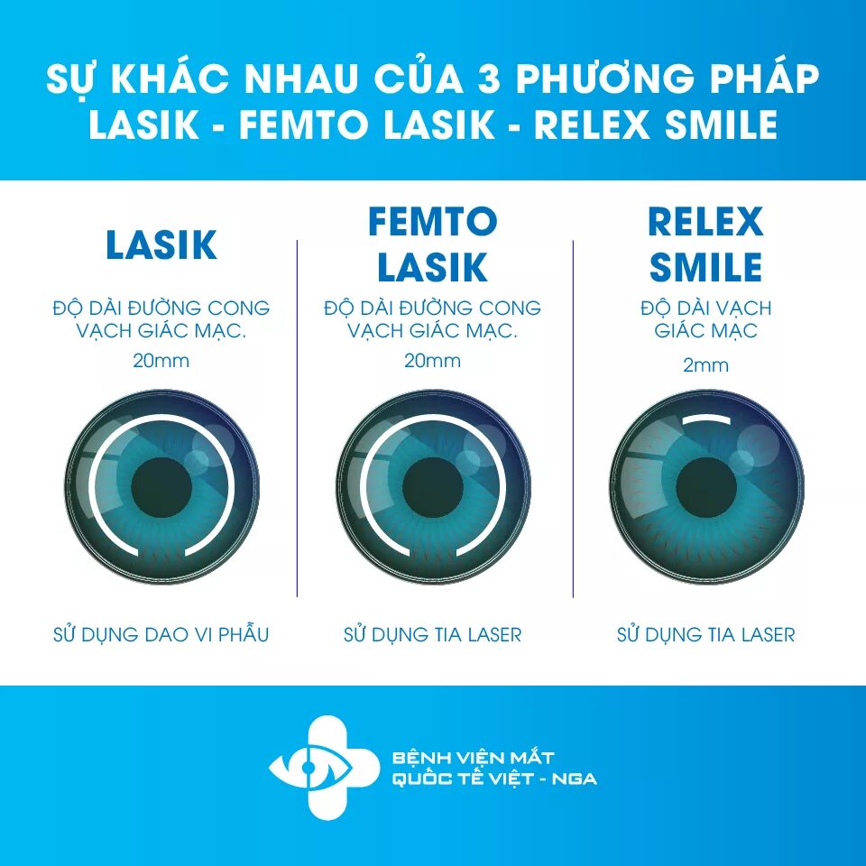 Фемто ласик. Разница LASIK ласик и ФЕМТОЛАСИК. Фемто Смайл.