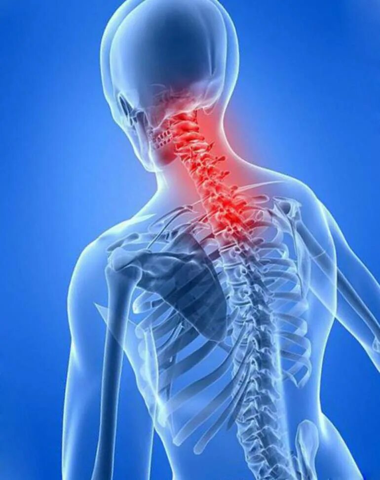 Миозит шампуни. Миозит шеи симптомы. Ботулинический миозит. Боль кожи при прикосновении на спине. Шейный миозит симптомы.