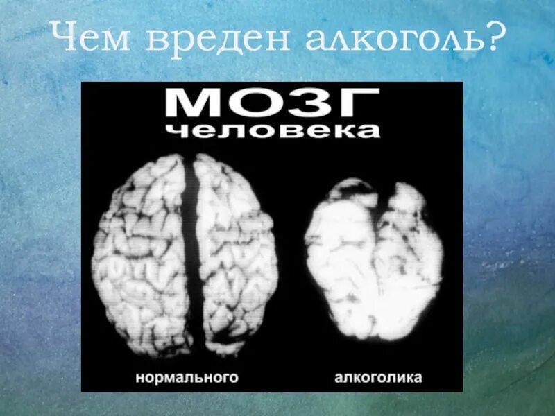 Состояние пьющего человека. Мозг здорового и пьющего человека. мозг нормального человека и алкоголика. здоровый мозг и мозг алкоголика.