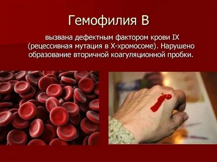 История болезни кровотечения