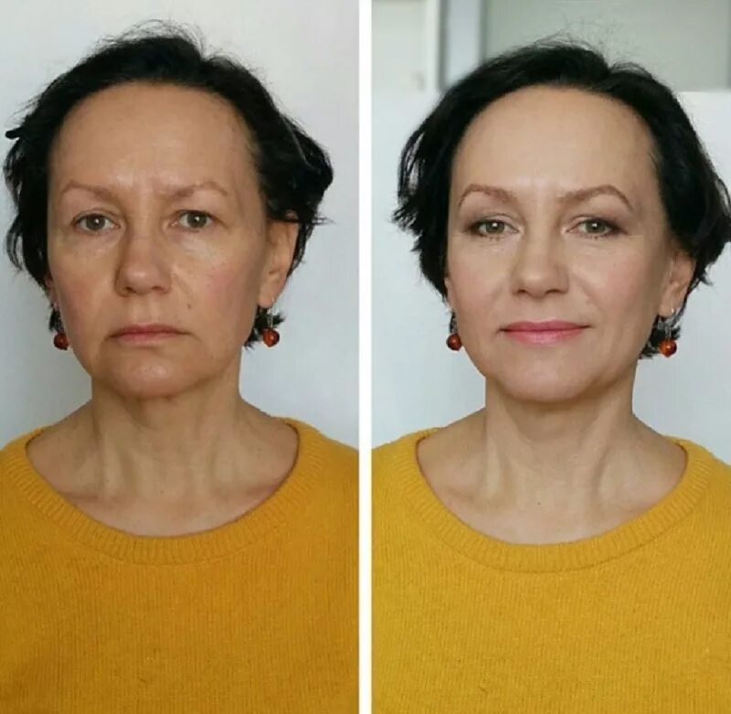 Лифтинг Нефертити ботоксом. Возрастной макияж до и после. Омоложение лица до и после. Макияж омолаживающий лицо.