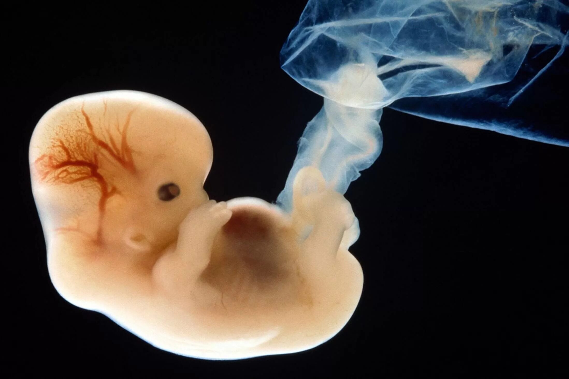 Embryo - Wikipedia