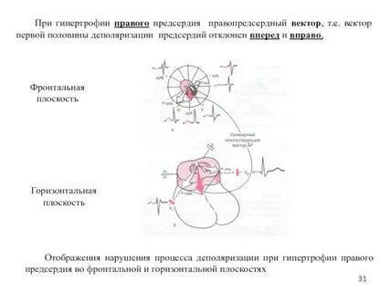 Экг отделы сердца