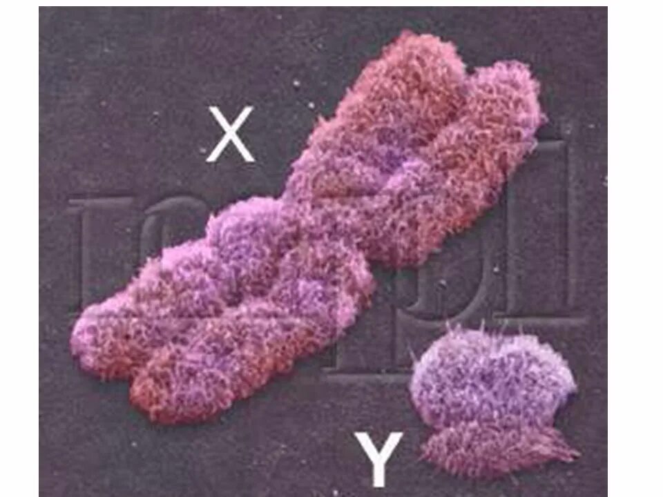 Вторая х хромосома. Икс хромосома и Игрек хромосома. Хромосомы в микроскопе. Хромосомы под микроскопом. Х Y хромосомы.