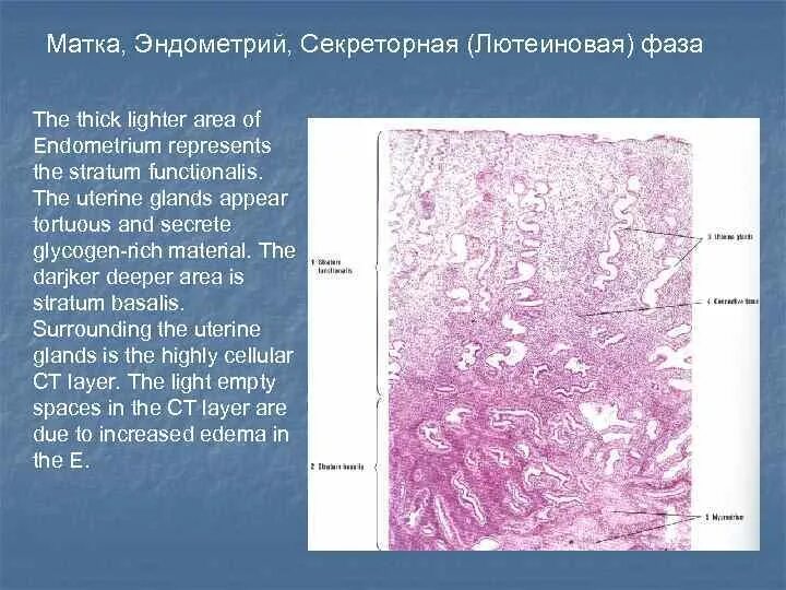 Строение эндометрия. Строение эндометрия гистология. Слизистая матки гистология. Строение матки гистология. Матка женщины гистология.