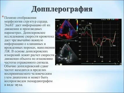 Допплерография как делают
