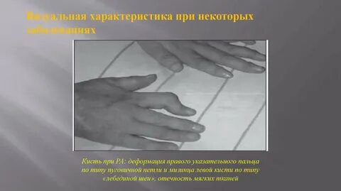 Дефекты кисти