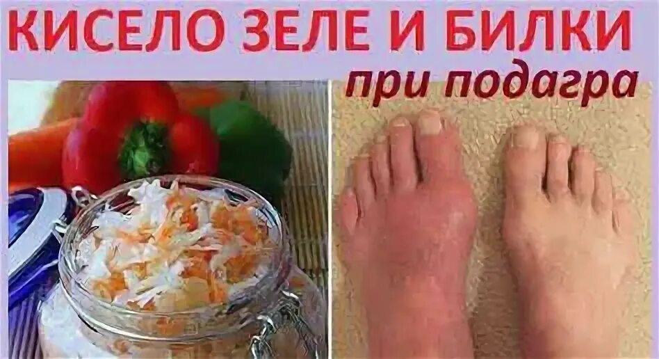 Подагра лечение диета