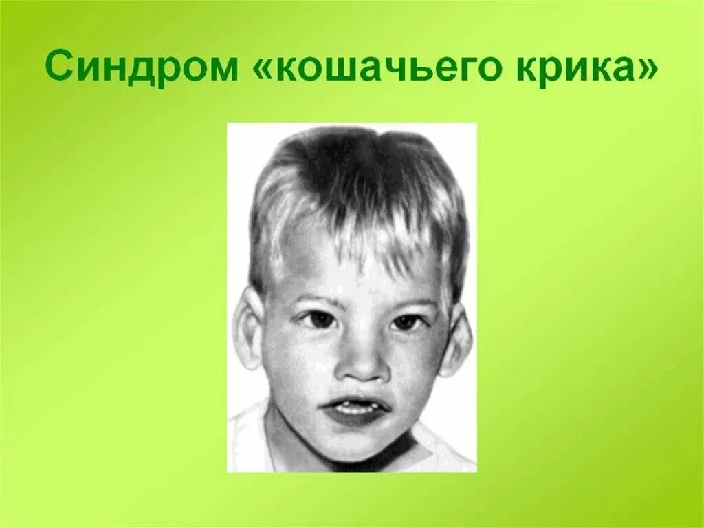 Кошачья болезнь у детей