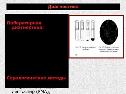 Пцр лептоспироз