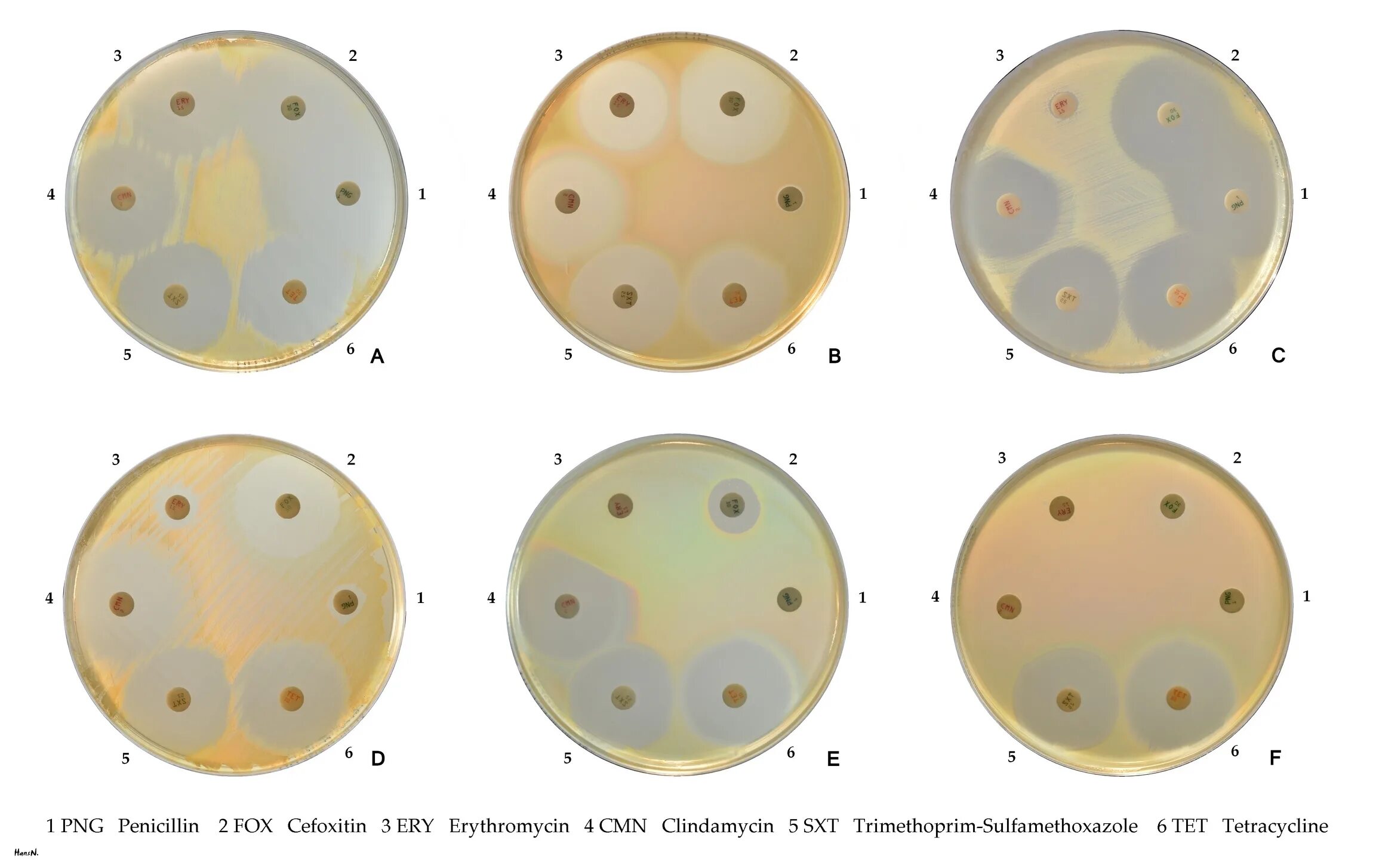 MRSA стафилококки антибиотики. Метициллин чувствительный стафилококк. MRSA-устойчивый золотистый стафилококк. Staphylococcus aureus 4