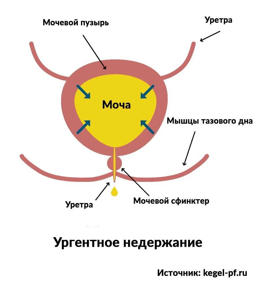 Непроизвольное Мочеиспускание У Женщин Во Время Секса