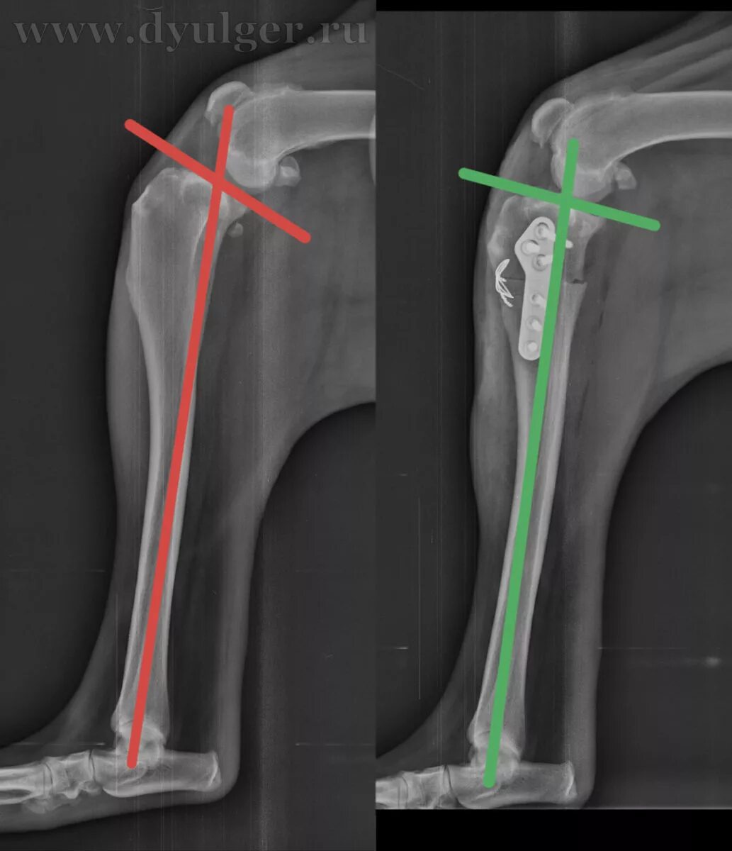 Разрыв связки у собаки. Разрыв ПКС У собаки рентген. ПКС У собаки операция TPLO. Разрыв передней крестообразной связки у собаки рентген. Коленный сустав разрыв ПКС собаки рентген.