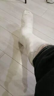 Мальчик сломал ногу