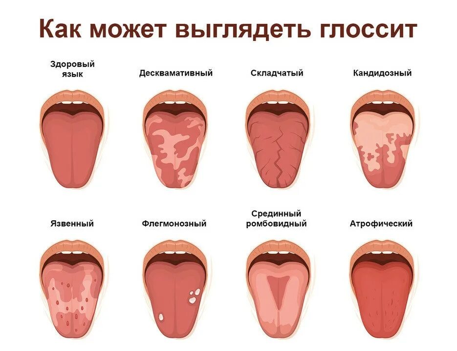 К какому врачу обращаться с губами. Язык злоровог очеловека.