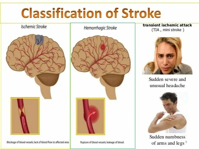 Stroke size. Stroke зфтук. kinds of strokes.