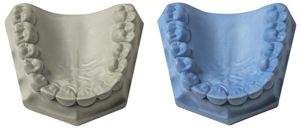 Изготовление гипсовой модели. Гипсовая Медель челючти. Гипсовая модель зубов. Гипсовые модели челюстей. Диагностические гипсовые модели.
