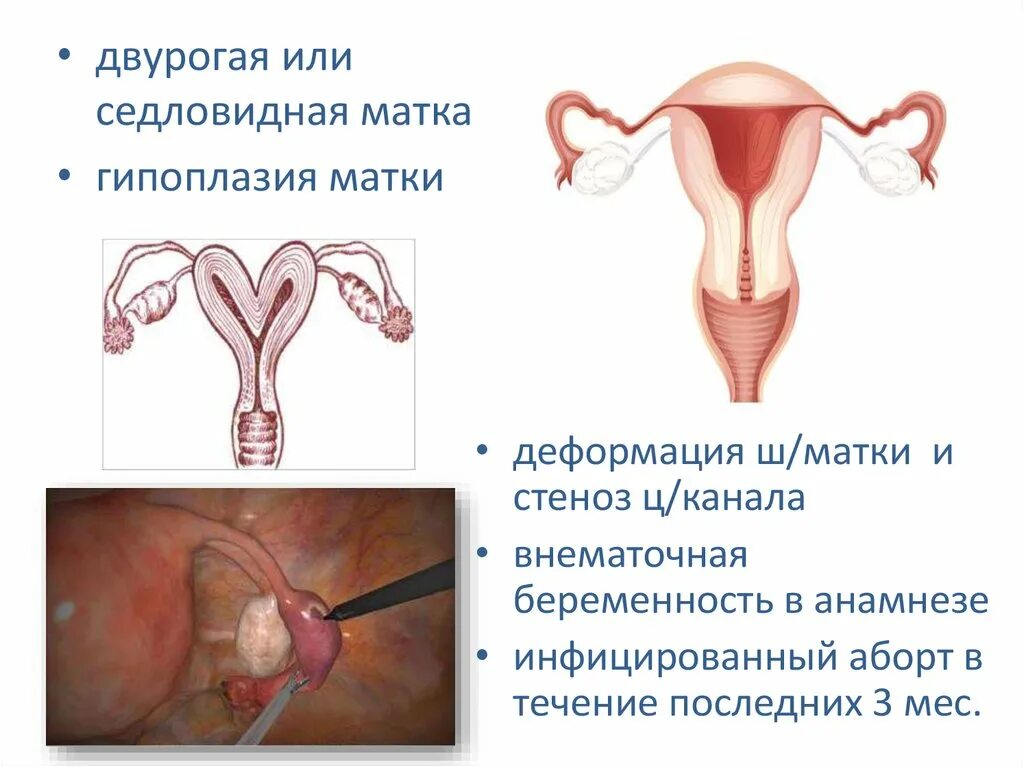 Матку девочка рассказ