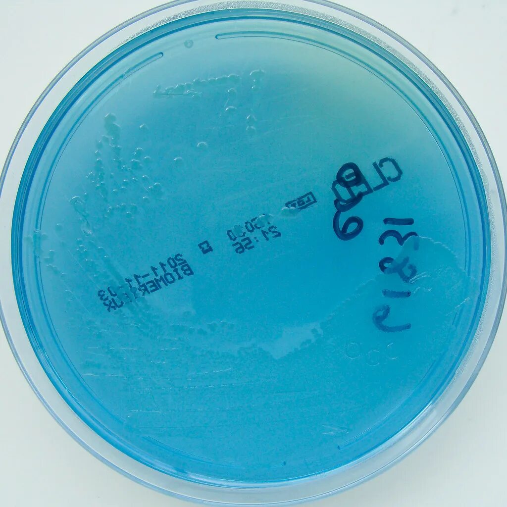 Spp salmonella spp shigella spp
